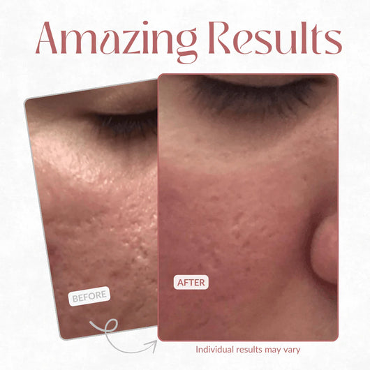 Facetique Pore Relief Multi Balm
