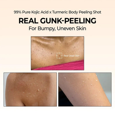 Facetique Kojic Acid Turmeric Spray