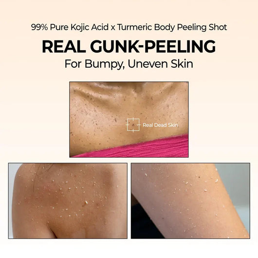 Facetique Kojic Acid Turmeric Spray