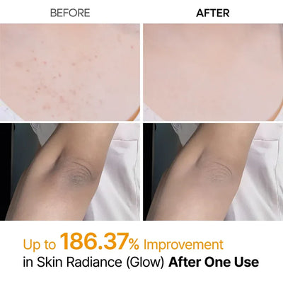 Facetique Kojic Acid Turmeric Spray