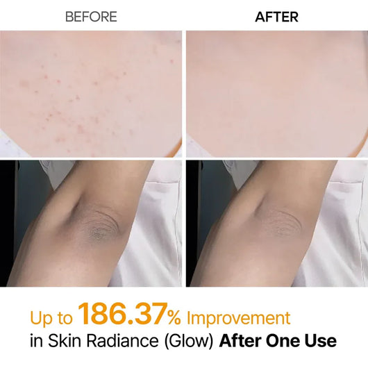 Facetique Kojic Acid Turmeric Spray