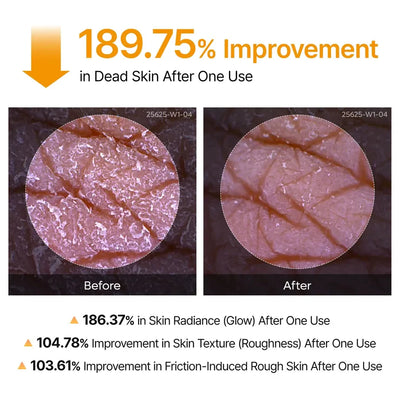Facetique Kojic Acid Turmeric Spray