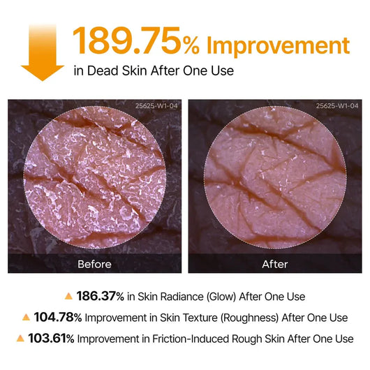 Facetique Kojic Acid Turmeric Spray