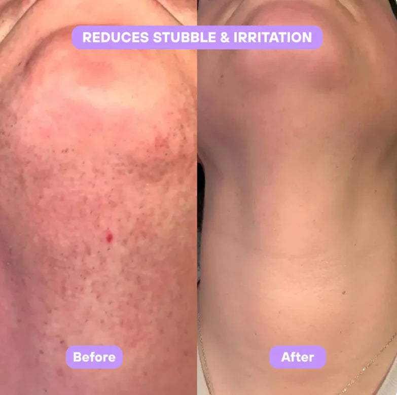 Facetique Cyperus Rotundus Skin Serum