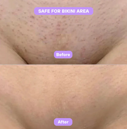 Facetique Cyperus Rotundus Skin Serum