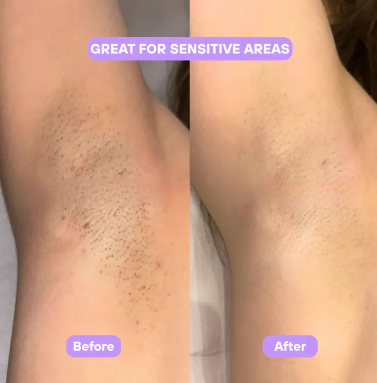 Facetique Cyperus Rotundus Skin Serum