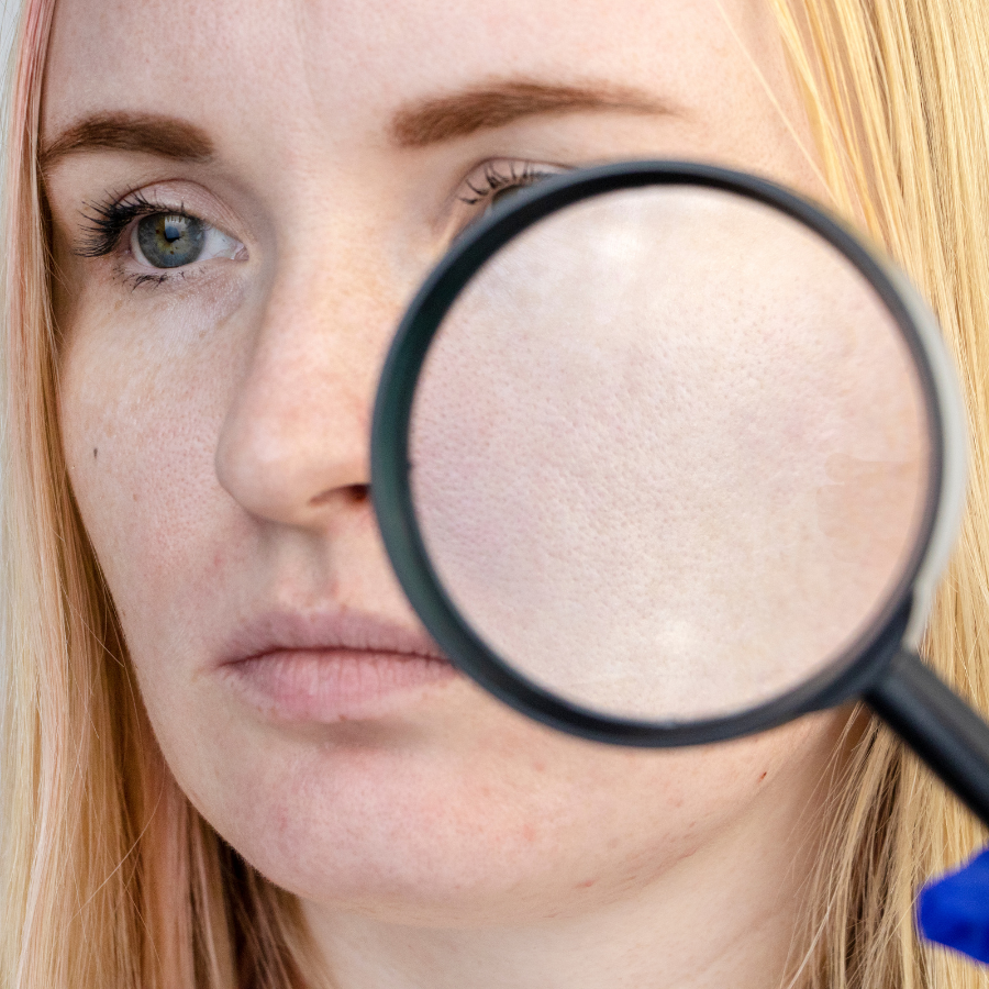 Why Pores Look Worse